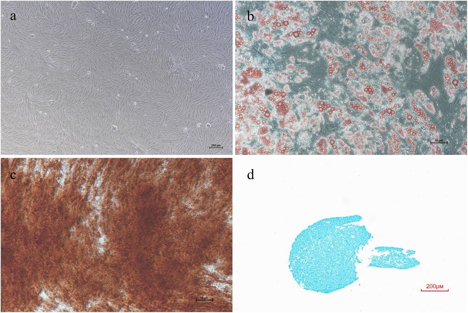 The effect of exogenous mitochondria in enhancing the survival and volume retention of transplanted fat tissue in a nude mice model