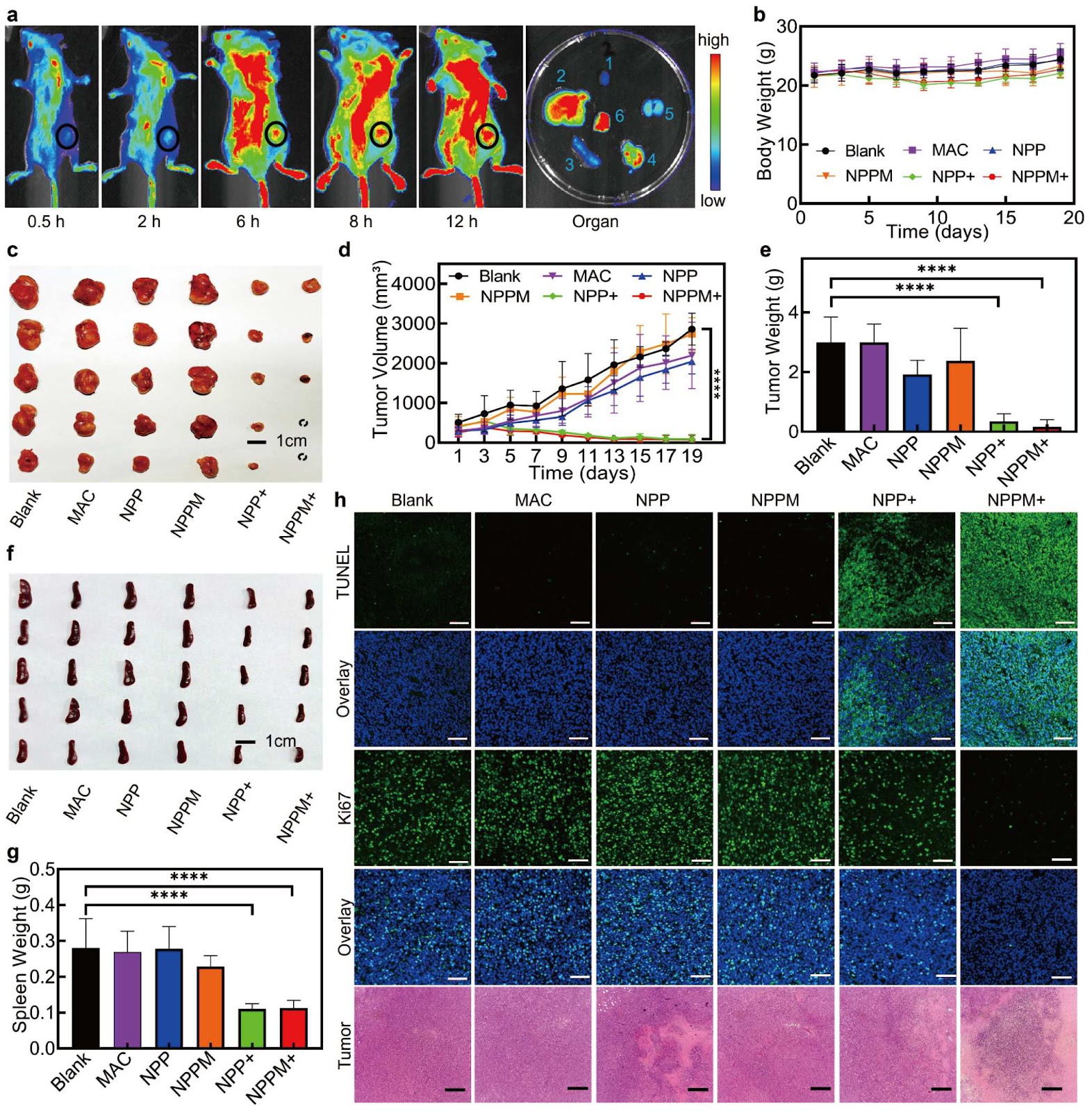 Chimeric Peptide-Engineered Photodynamic PD-L1 Degrader for Activating Colorectal Cancer Immunity in Combination with Exosomal PD-L1 Inhibition