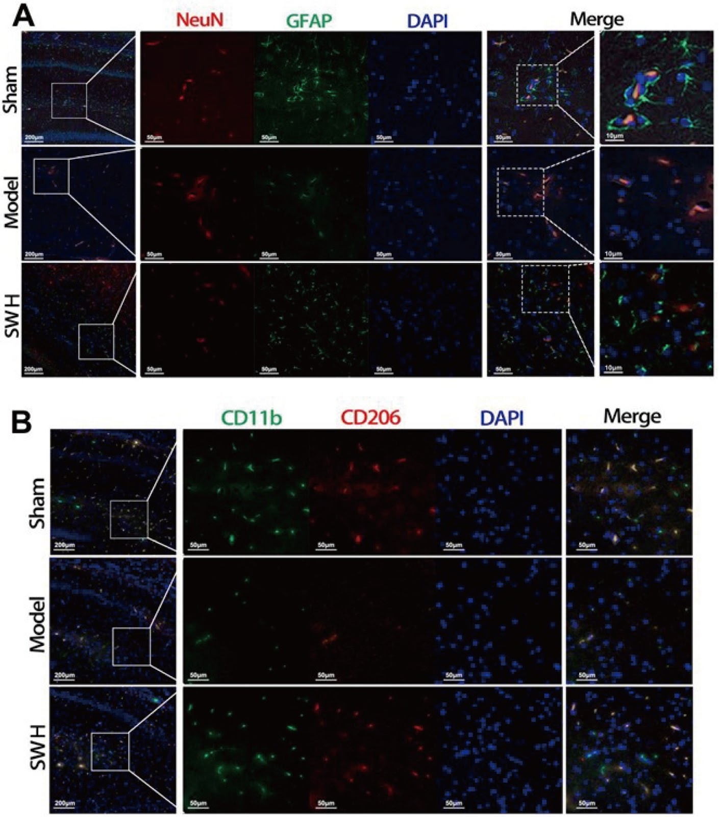 A traditional formula of aconitum complex alleviates post-ischemic stroke by improving neural function