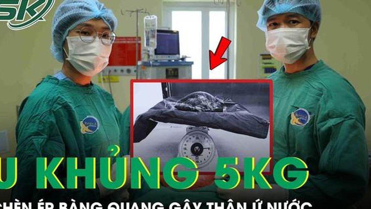 Người phụ nữ 53 tuổi mang khối u xơ tử cung khổng lồ nặng gần 5kg chèn ép bàng quang - Báo Sức Khỏe &amp; Đời Sống