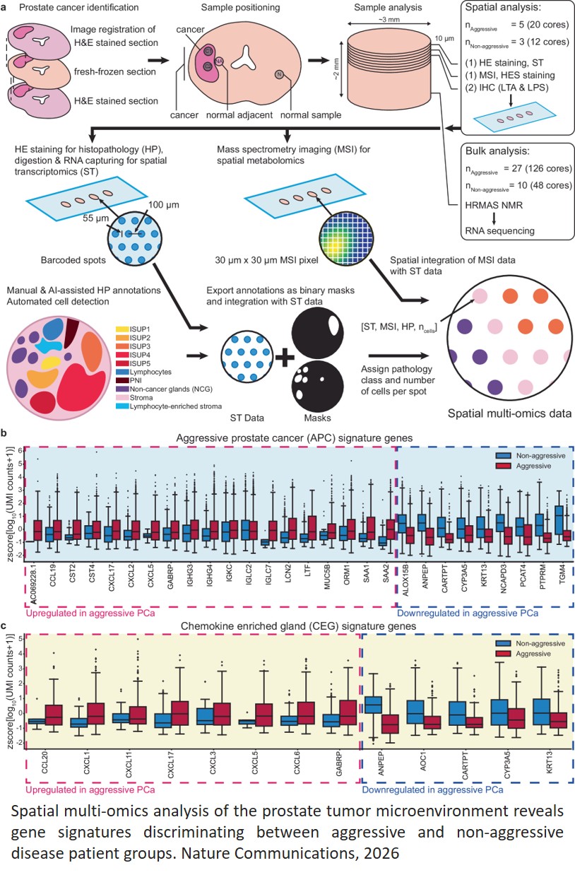 Spatial multi-omics identifies aggressive  prostate cancer signatures highlighting pro- inflammatory chemokine activity in the  tumor microenvironment