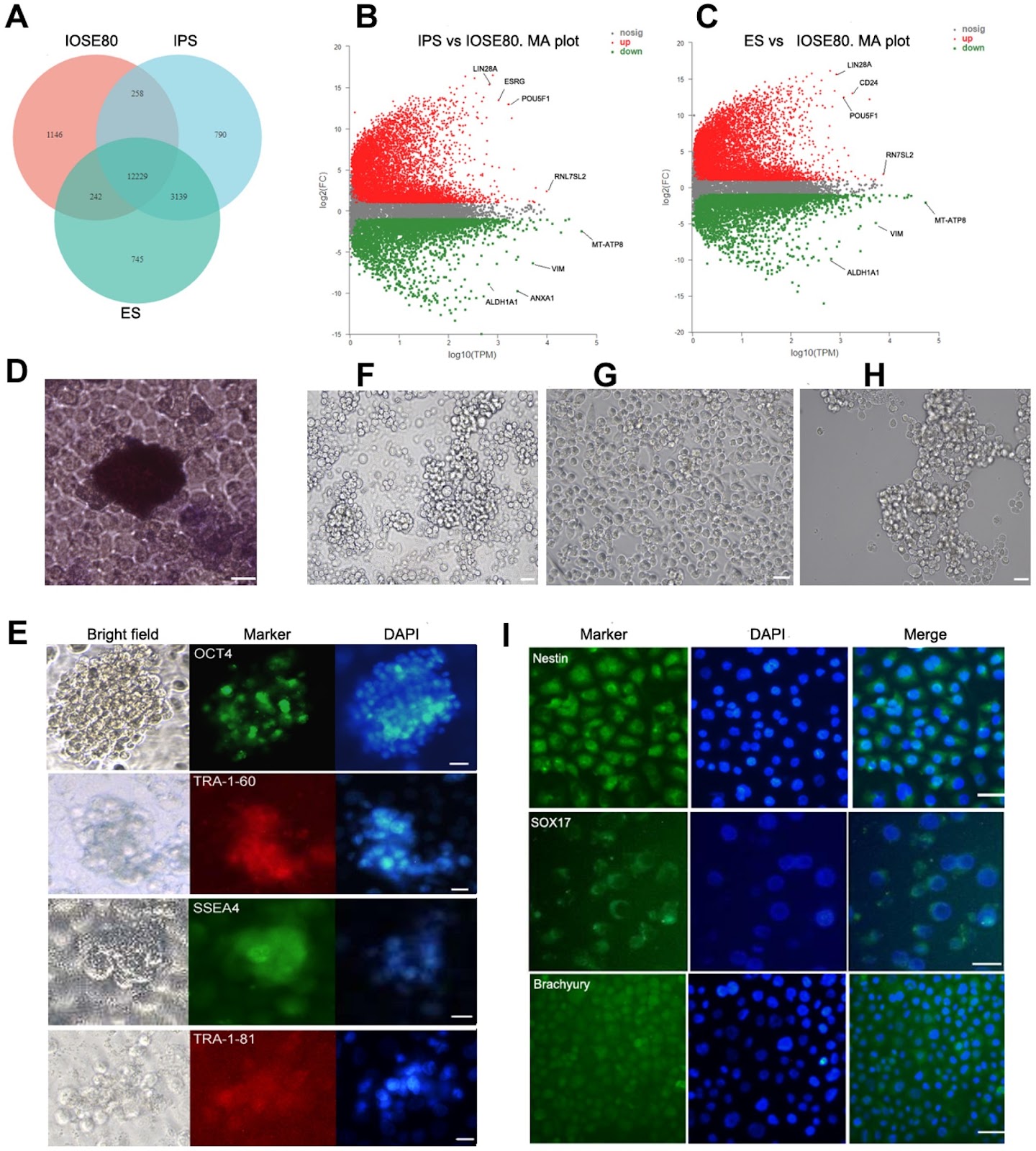 Identification and characterization of multipotential stem cells in immortalized normal ovarian surface epithelial cells