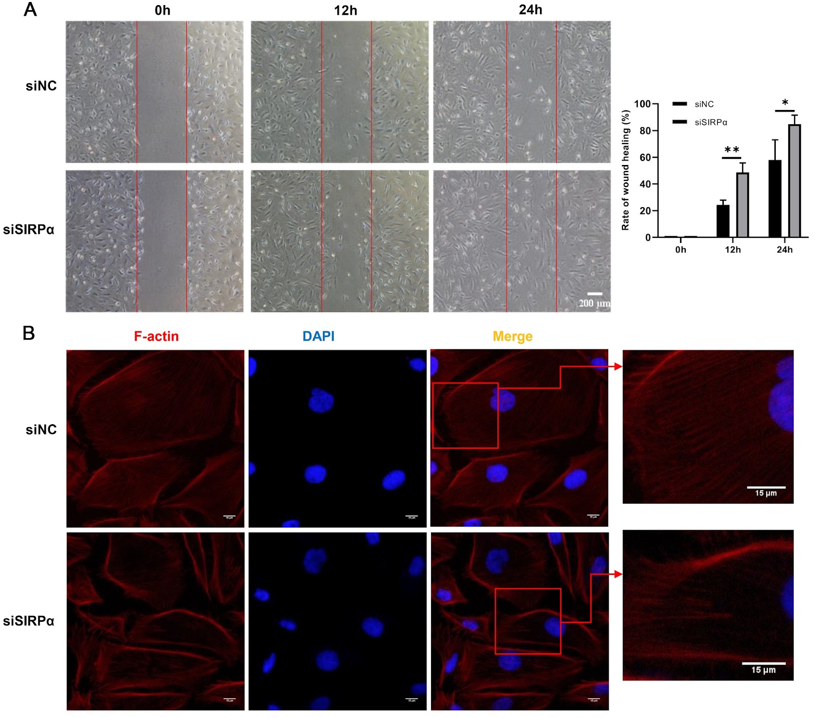 SIRPα modulates the podocyte cytoskeleton through influencing the phosphorylation of FAK at tyrosine residue 597