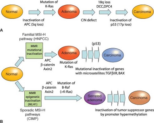 Comprehensive Pan-Cancer Assessment of the APC I1307K Variant Reveals Ancestry-Independent Colorectal Cancer Risk
