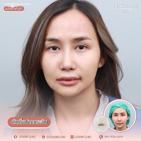 ตกแต่งริมฝีปาก