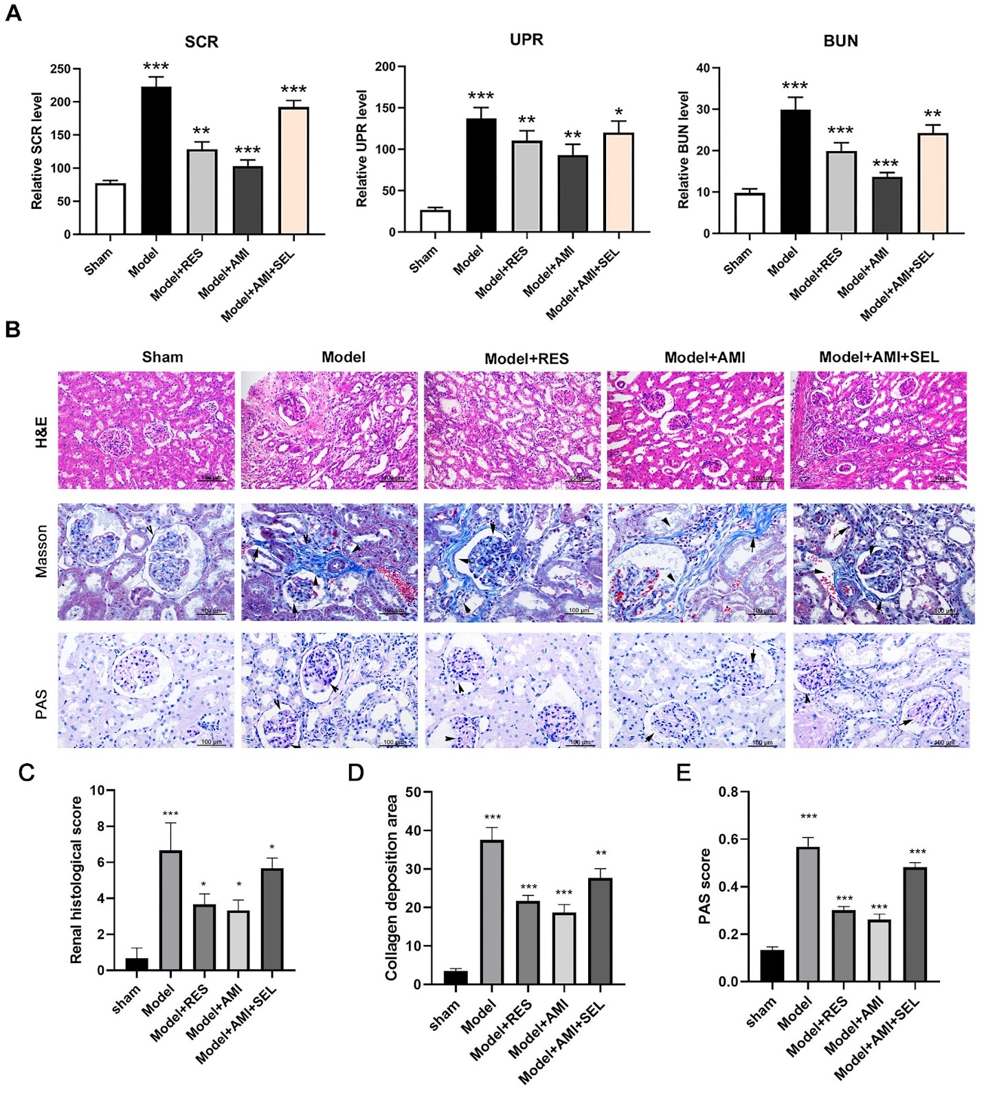 Aminophylline suppresses chronic renal failure progression by activating SIRT1/AMPK/mTOR-dependent autophagy