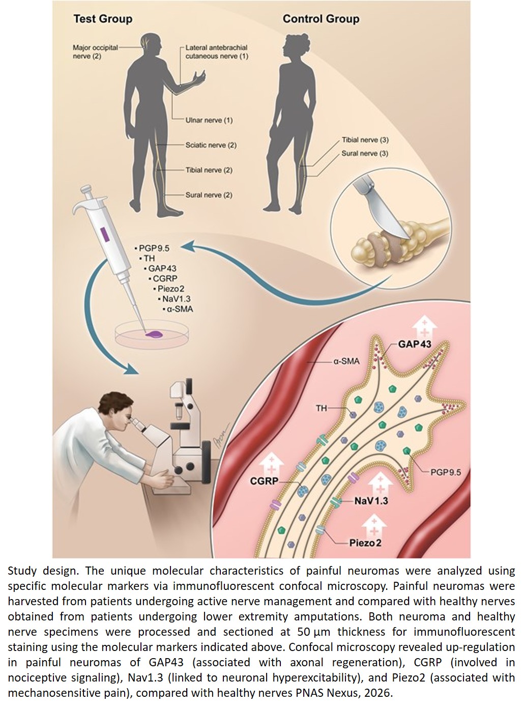 Painful neuromas exhibit axonal phenotypic shift via nociceptive and mechanosensitive marker up-regulation