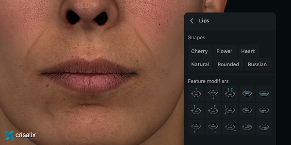 Simulation 3D des visages dans l’application Crisalix avec l’outil de procédure « Lips » ouvert. 2400px x 1200px.