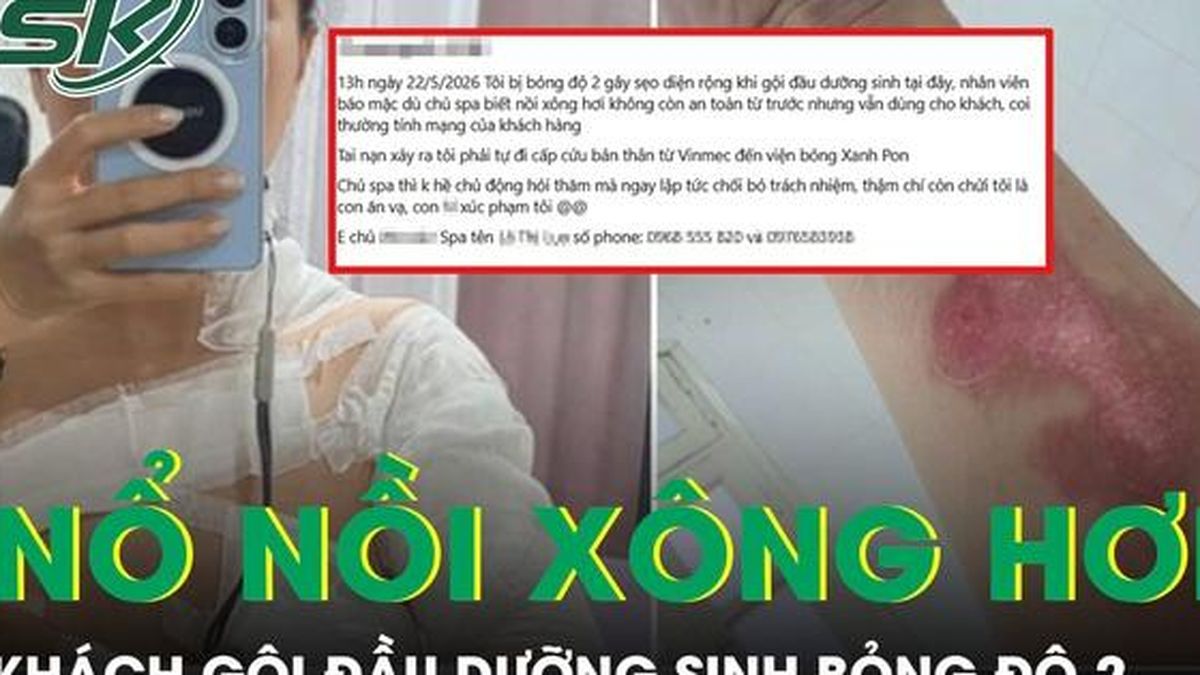 Nổ nồi xông hơi khi gội đầu dưỡng sinh, nữ khách bỏng độ 2 vùng cổ và ngực - Báo Sức Khỏe &amp; Đời Sống