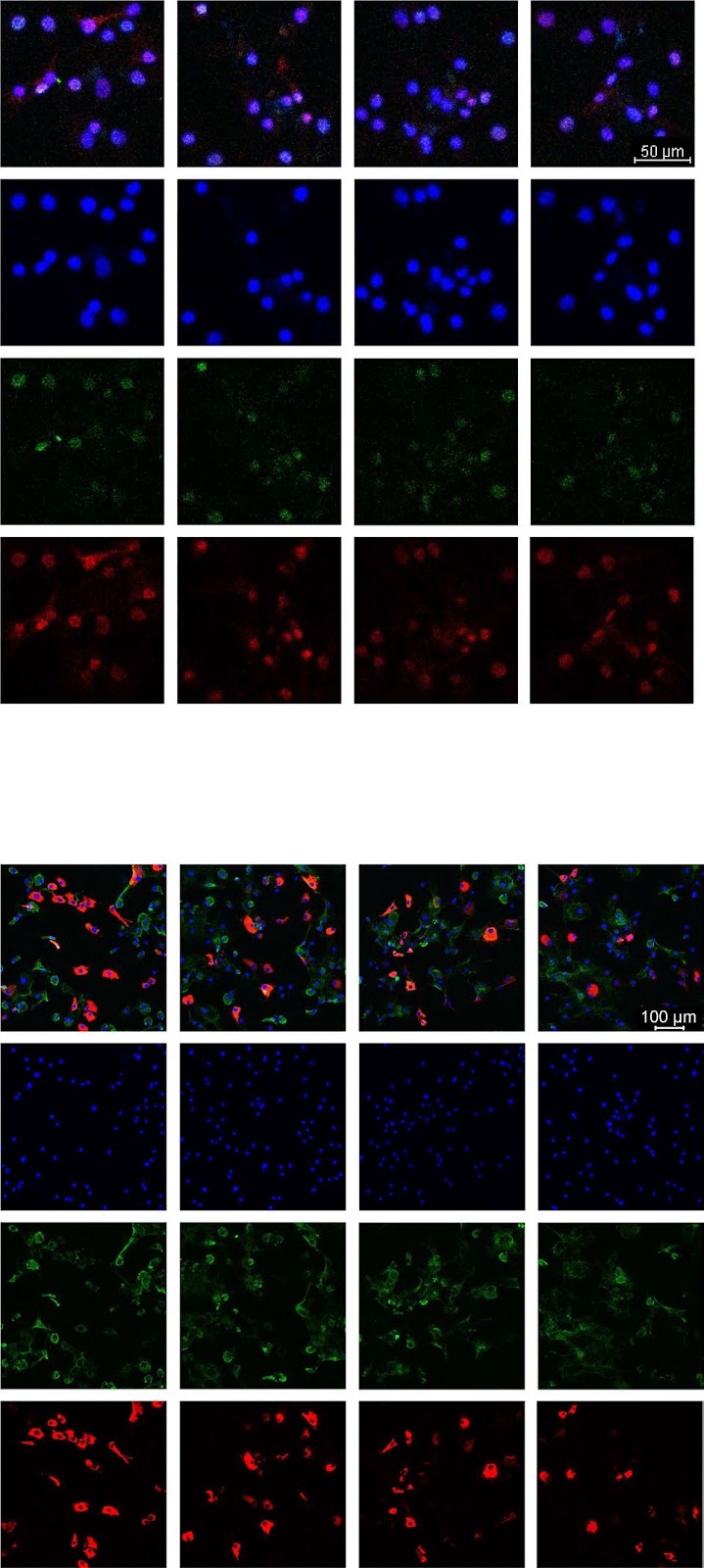 Combination of rapamycin and adipose-derived mesenchymal stromal cells enhances therapeutic potential for osteoarthritis