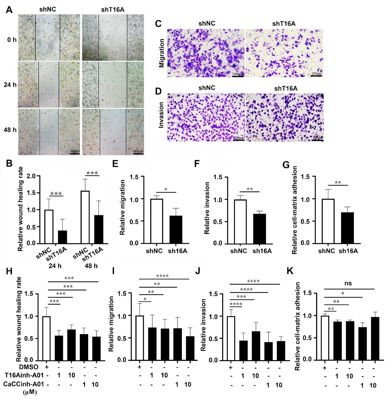 TMEM16A inhibition suppresses melanoma metastasis