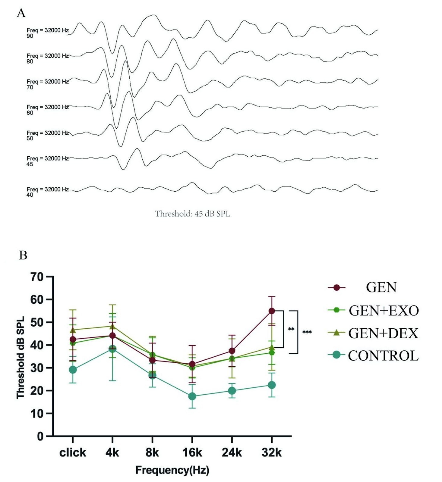 Mesenchymal stem cell-derived exosomes ameliorate gentamicin-induced vestibular hair cell injury by regulating the SNARE pathway and enhancing autophagy