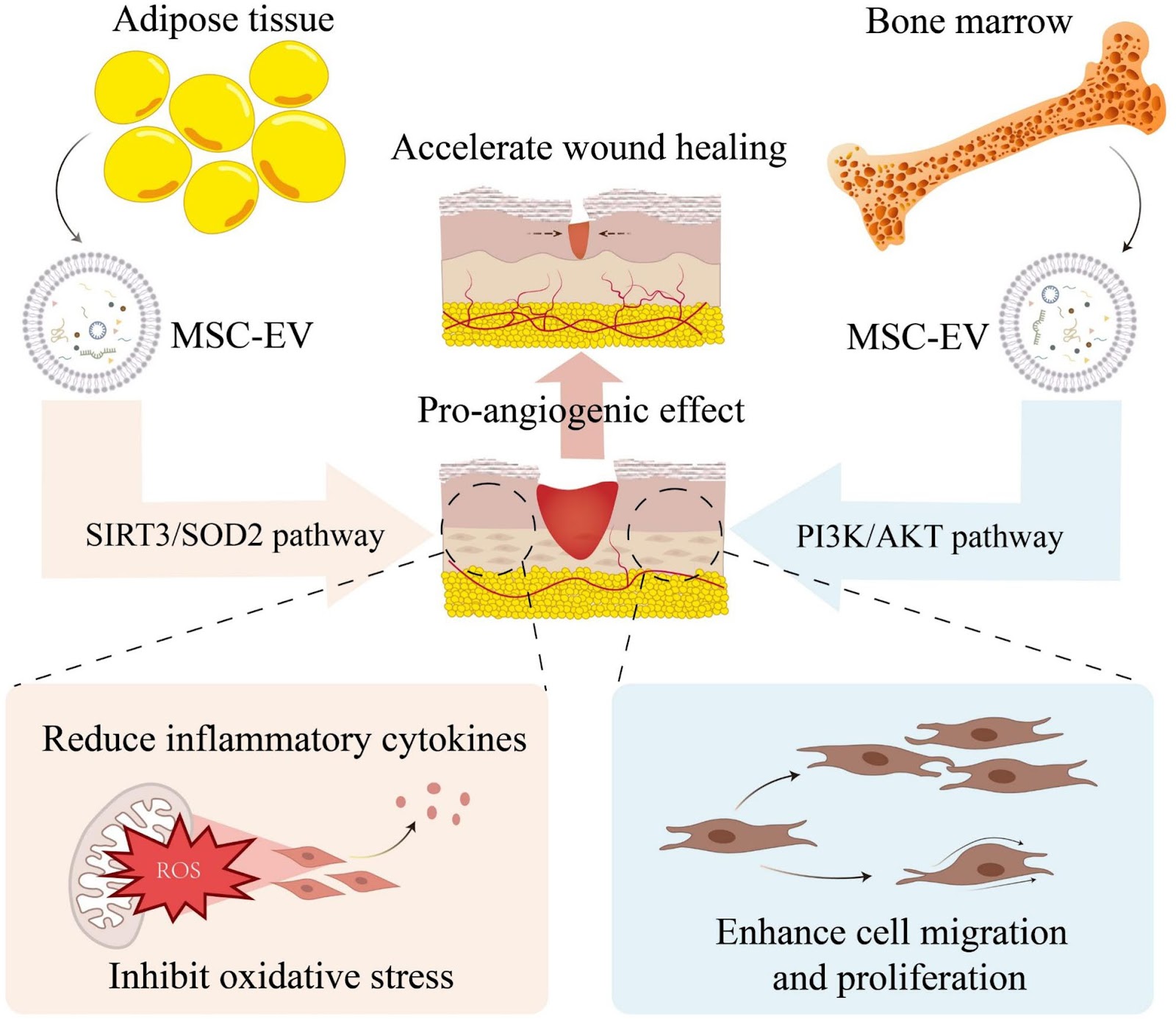 Mesenchymal stem cell-derived extracellular vesicles in the treatment of type 2 diabetes and its complications: current progress and future directions