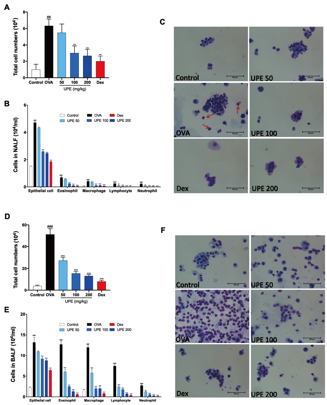 Undaria pinnatifida extract attenuates combined allergic rhinitis and asthma syndrome by the modulation of epithelial cell dysfunction and oxidative stress