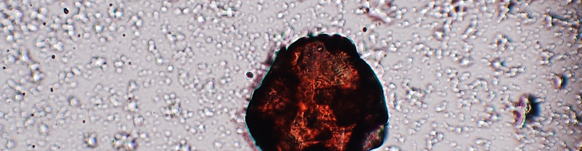 Observation and Interpretation of Micro-Residues on Archeological Artefacts: Exploring the Applicability of Confocal Laser Induced Fluorescence (CLIF) Technique