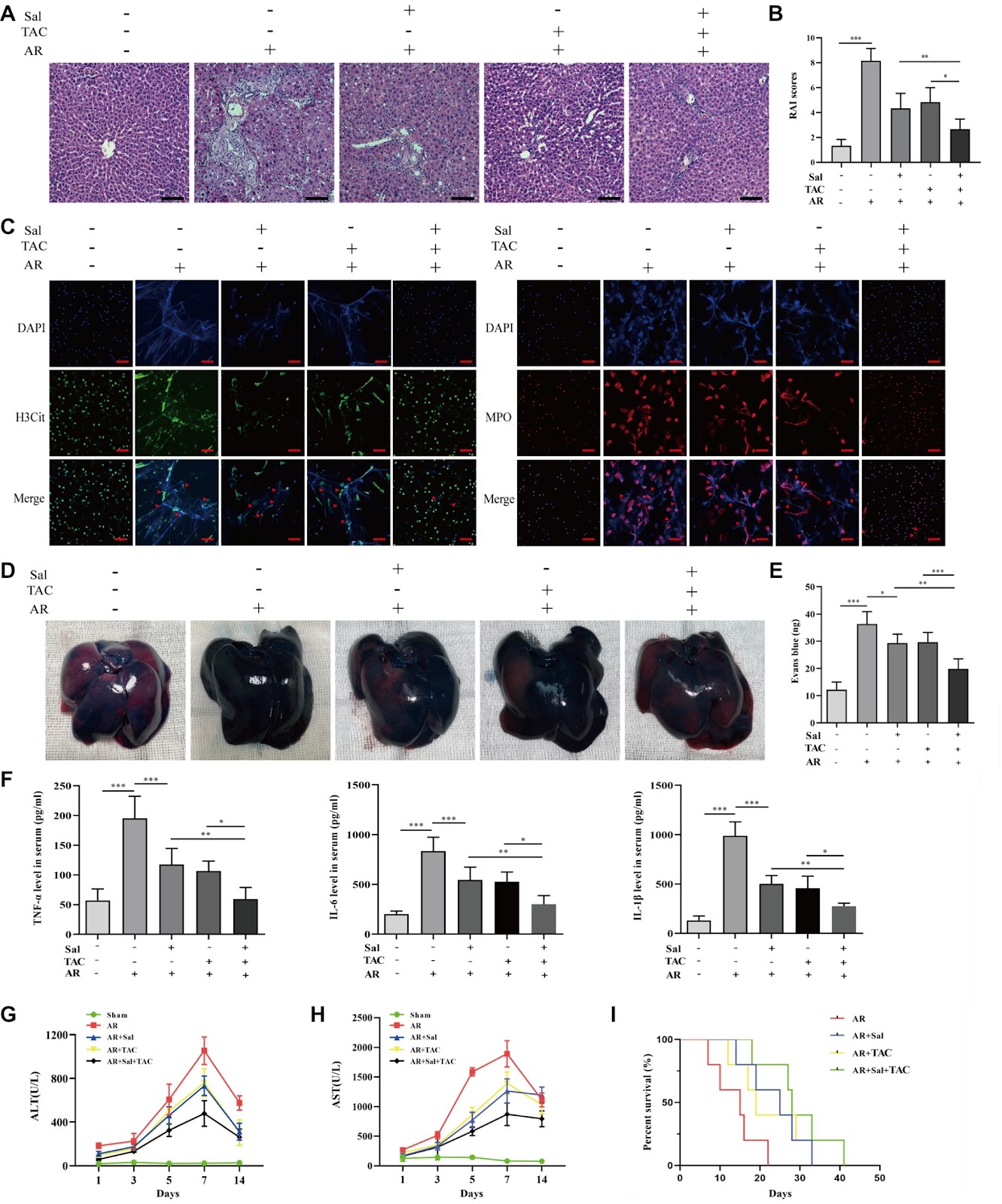 Salidroside ameliorates acute liver transplantation rejection in rats by inhibiting neutrophil extracellular trap formation