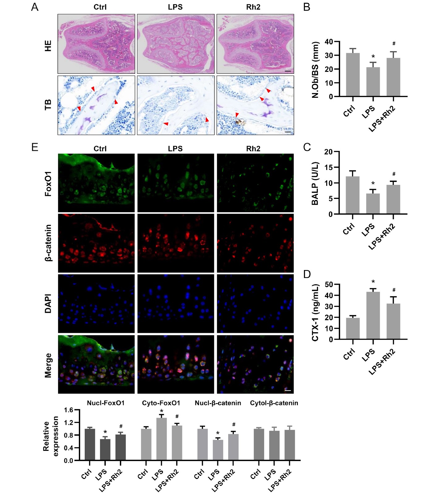Ginsenoside Rh2 alleviates osteoporosis by attenuating oxidative stress-induced osteoblast dysfunction via the FoxO1/β-catenin pathway