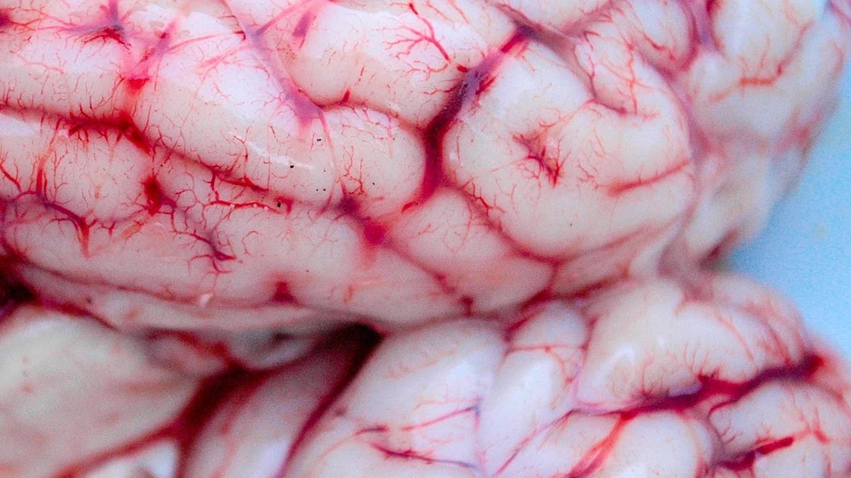 비판적 사고를 방해하는 인지 편향과 논리 오류 사례