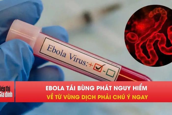 WHO cảnh báo Ebola bùng phát, người về Việt Nam theo dõi 21 ngày - Tạp chí Tiếp thị &amp; Gia đình