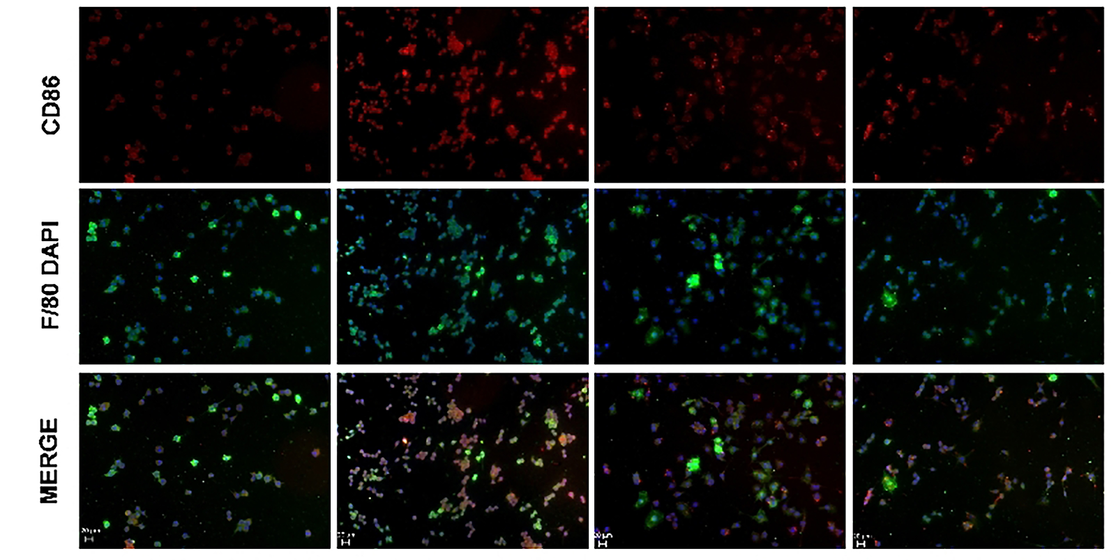 Mechanism by which Hernandezine alleviates osteoporosis through macrophage polarization and osteoclast activation