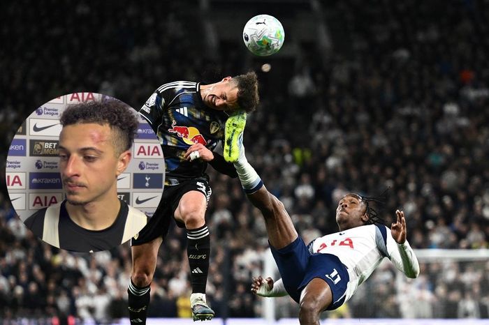 Sai lầm ngớ ngẩn của cầu thủ Tottenham - Tạp chí Tri thức