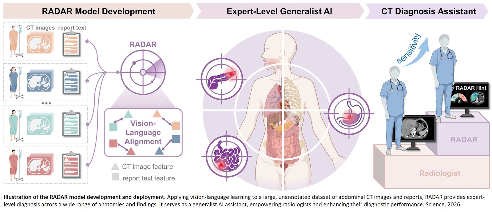 A generalist AI tool for abdominal CT diagnosis