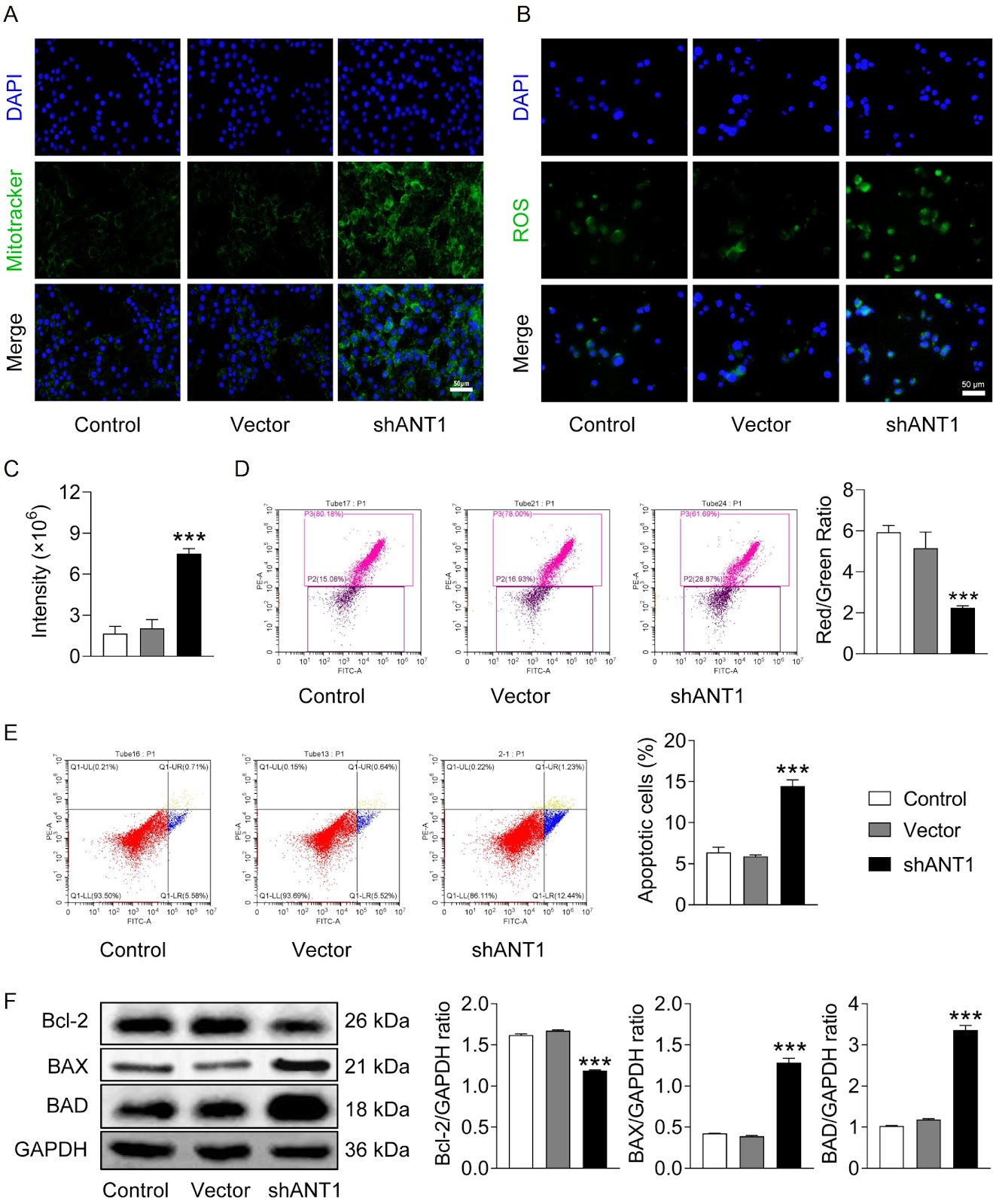 ANT1 suppression inhibits the progression of colorectal cancer by suppressing PINK1/Parkin-mediated mitophagy