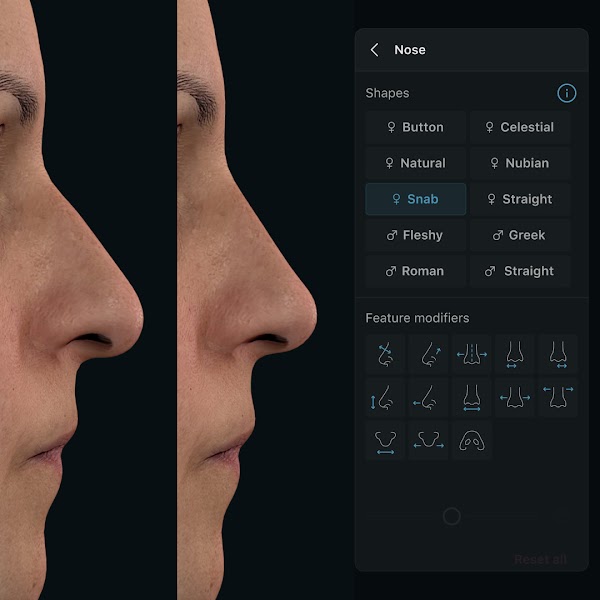 Simulation 3D des visages dans l’application Crisalix avec l’outil de procédure « Nose » ouvert. 1080px x 1080px.