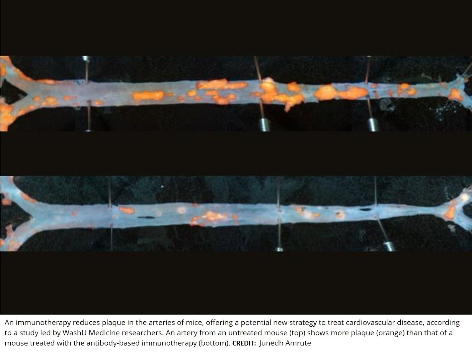 Immunotherapy reduces plaque in arteries of mice