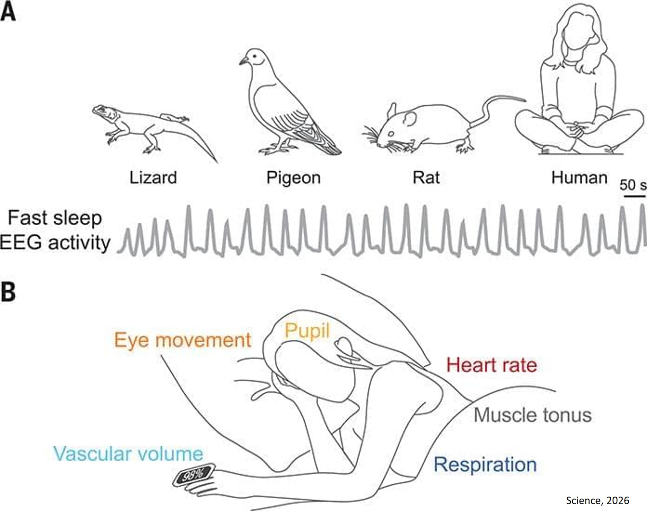 How sleep, waste clearance, and dementia are linked?