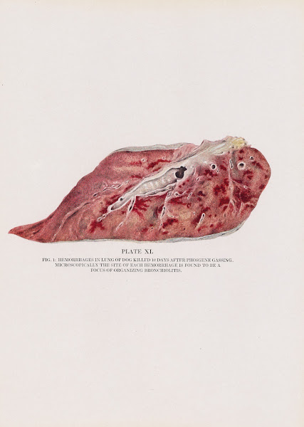 Plate XL Fig 1 Hemorrhages in lung of dog killed 10 days after phosgene gassing