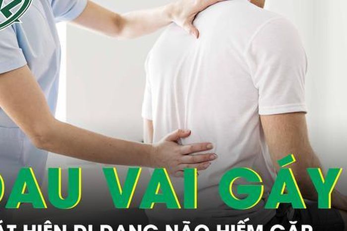 Thường xuyên đau vai gáy, người đàn ông sốc khi biết mình mắc dị dạng não hiếm gặp - Báo Sức Khỏe &amp; Đời Sống
