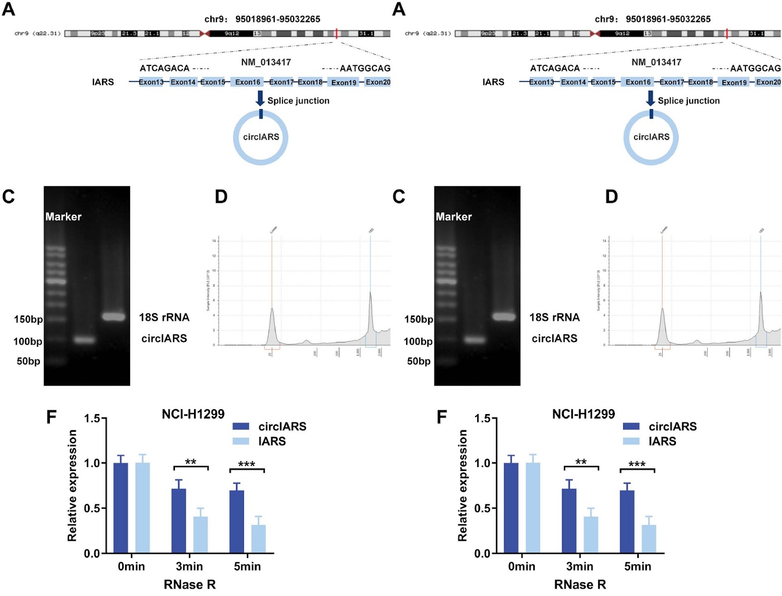 circIARS: a potential plasma biomarker for diagnosing non-small cell lung cancer