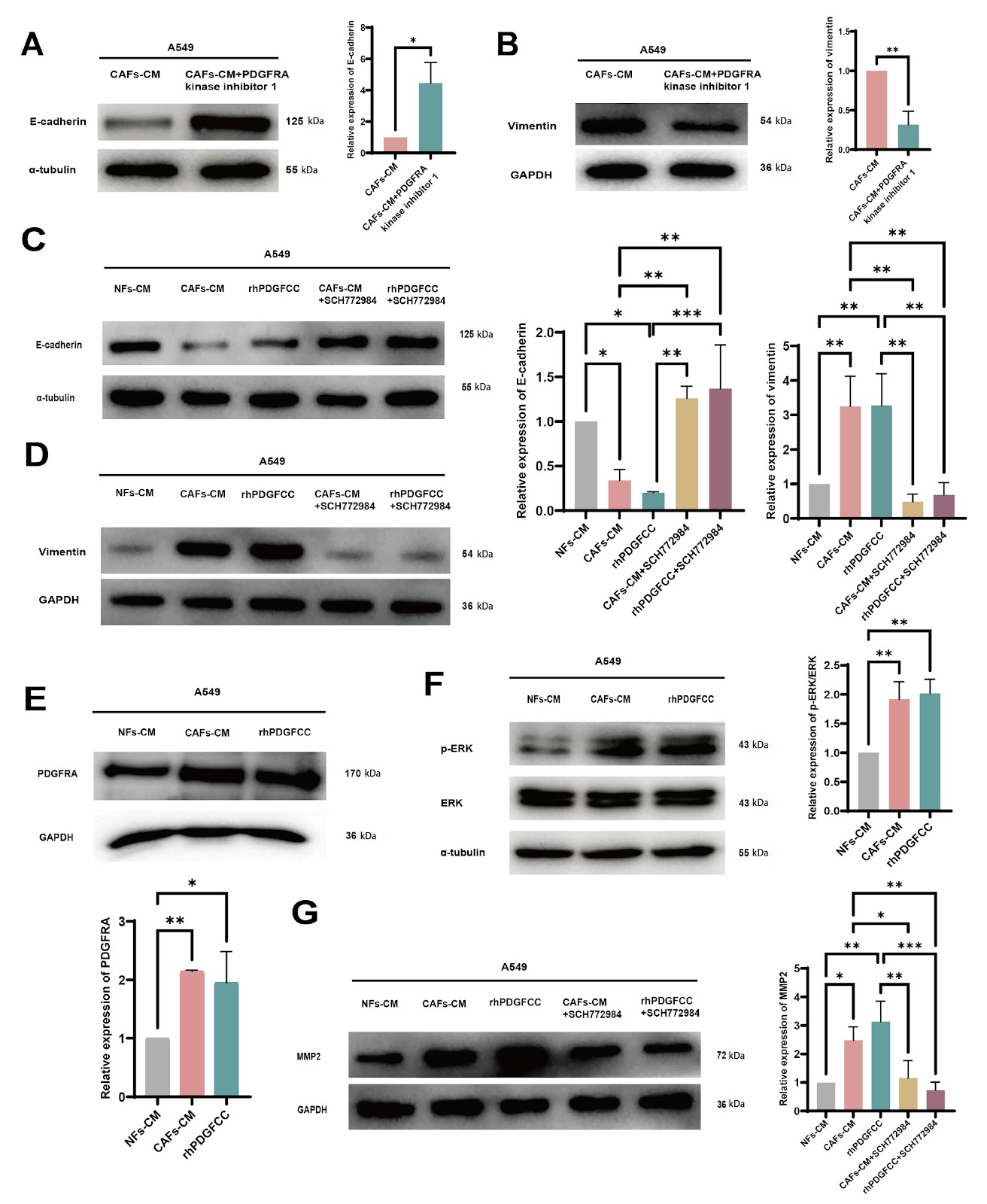 PDGFC Secreted by Cancer-Associated Fibroblasts Promotes Epithelial-Mesenchymal Transition and Immunosuppression in Lung Adenocarcinoma