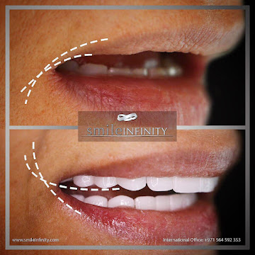 Hollywood smile New York medical tourism Beirut Lebanon — Smile Infinity Dr. Habib Zarifeh