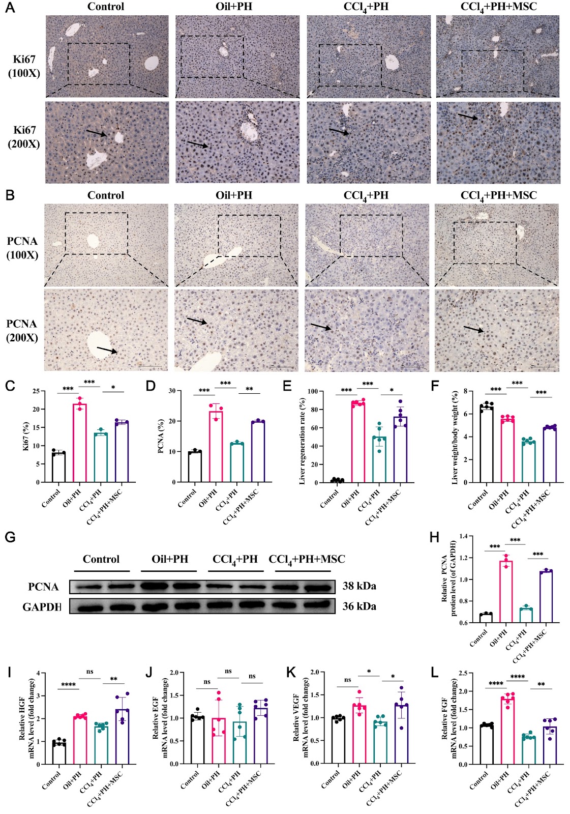 Human umbilical cord mesenchymal stem cells enhance liver regeneration and decrease collagen content in fibrosis mice after partial hepatectomy by activating Wnt/β-catenin signaling