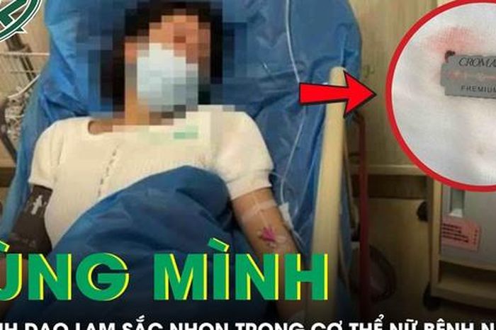 Rùng mình cảnh bác sĩ lấy ra 6 mảnh dao lam sắc nhọn từ cơ thể nữ bệnh nhân - Báo Sức Khỏe &amp; Đời Sống