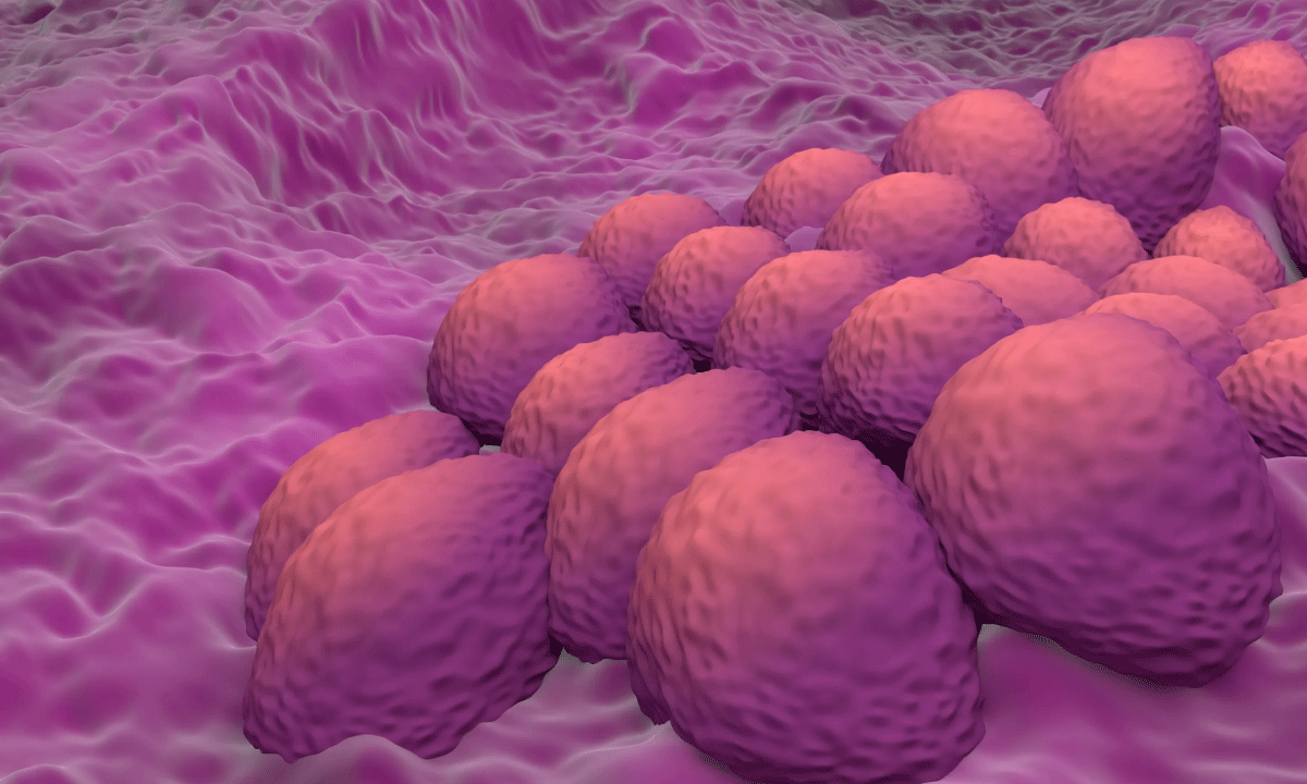 Investigadores desarrollan modelo de IA para detectar cáncer endometrial con alta precisión