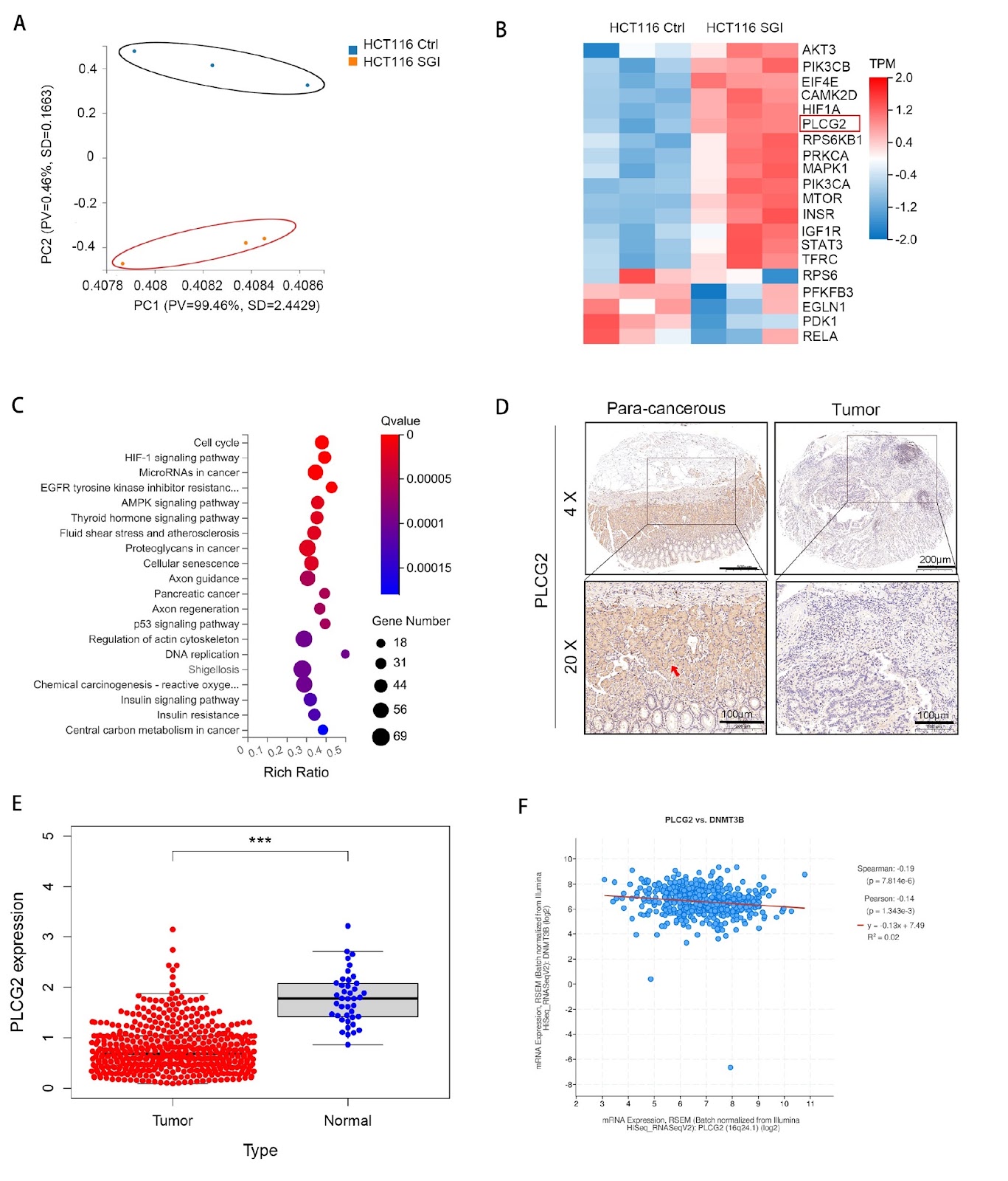 Methyltransferase DNMT3B promotes colorectal cancer cell proliferation by inhibiting PLCG2