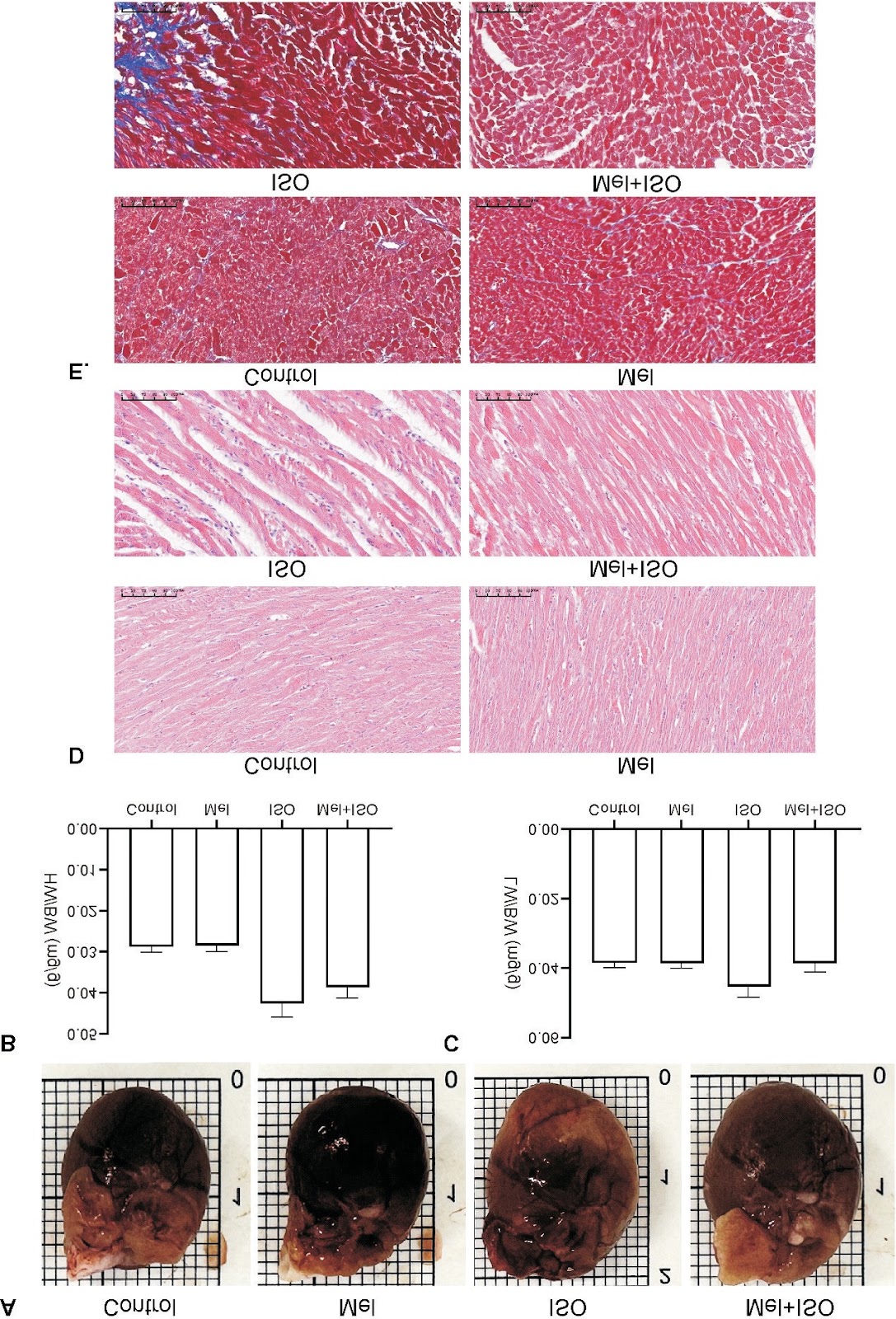 Melatonin alleviated acute myocardial infarction by inhibiting ferroptosis