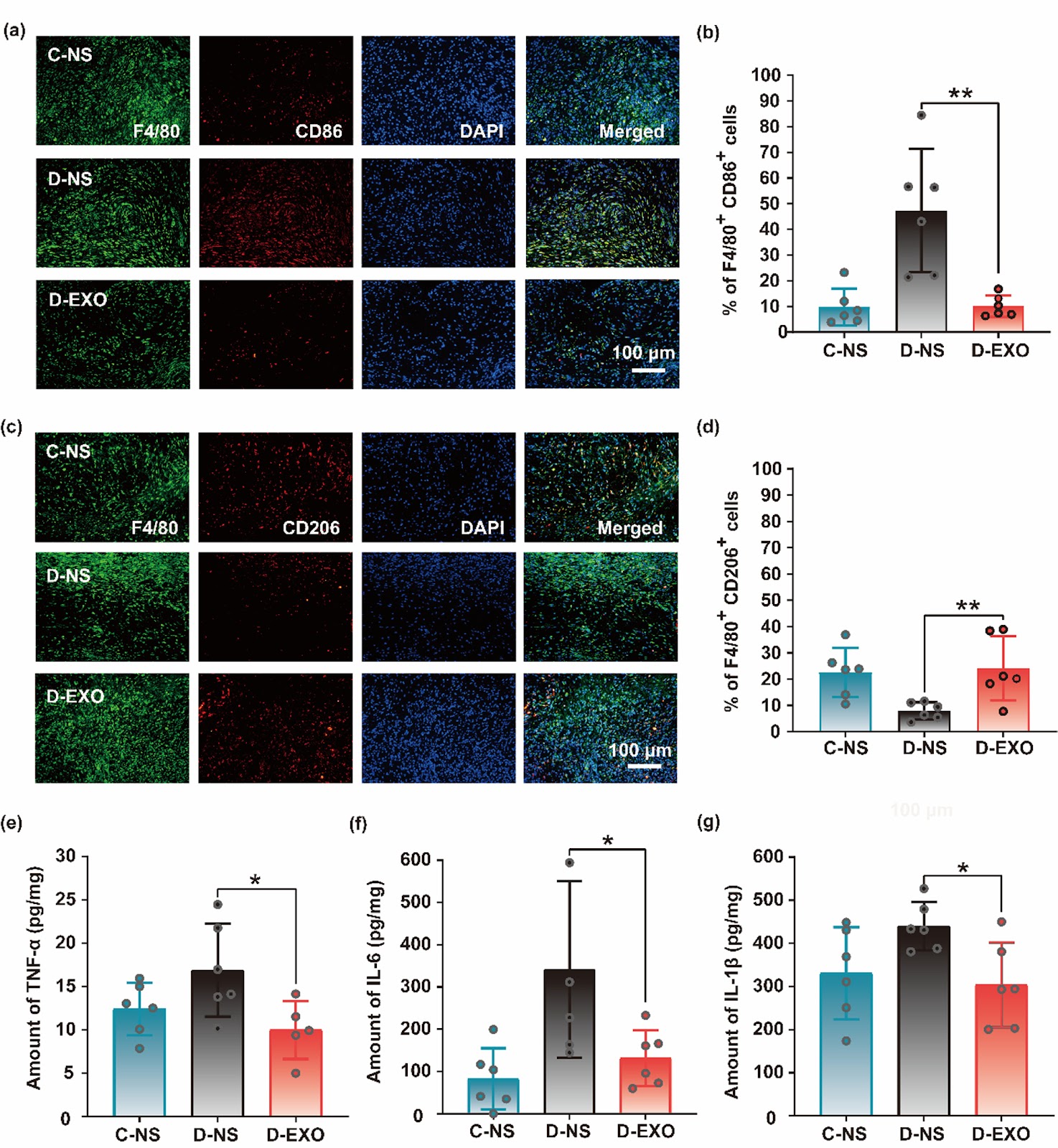iPSC-derived exosomes promote diabetic wound healing by attenuating inflammatory responses
