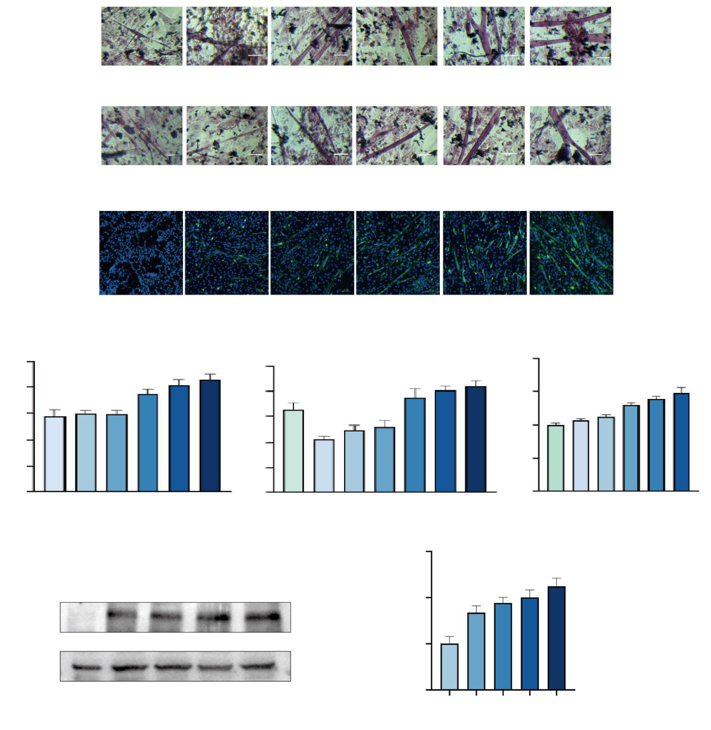 Mechanistic Investigation of the Iridoid Fraction from Morinda officinalis in the Treatment of Aging-Related Sarcopenia via the PI3K/Akt/mTOR Signaling Pathway