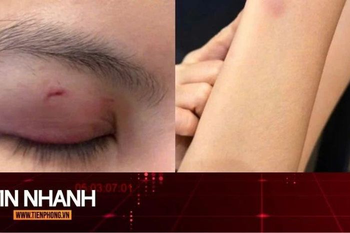 TIN NHANH: Luật sư nhận định vụ ca sĩ Trung Quân Idol bị tố đánh phụ nữ - Báo Tiền Phong