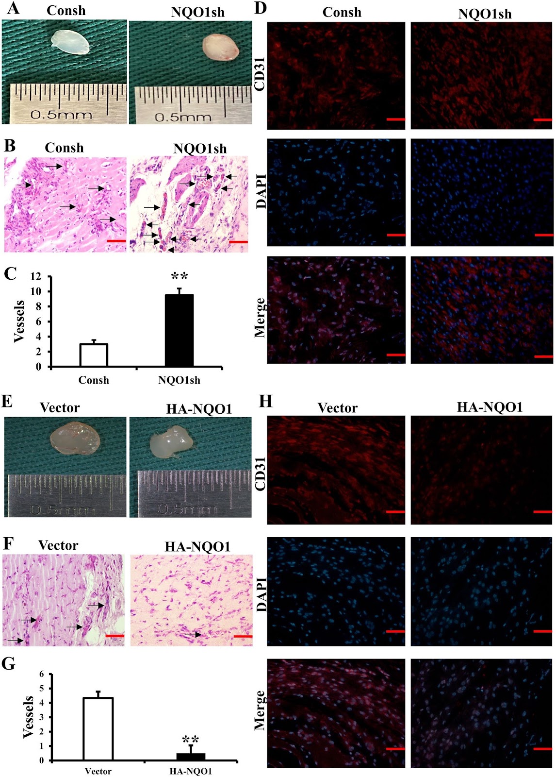 NQO1 promotes osteogenesis and suppresses angiogenesis in DPSCs via MAPK pathway modulation