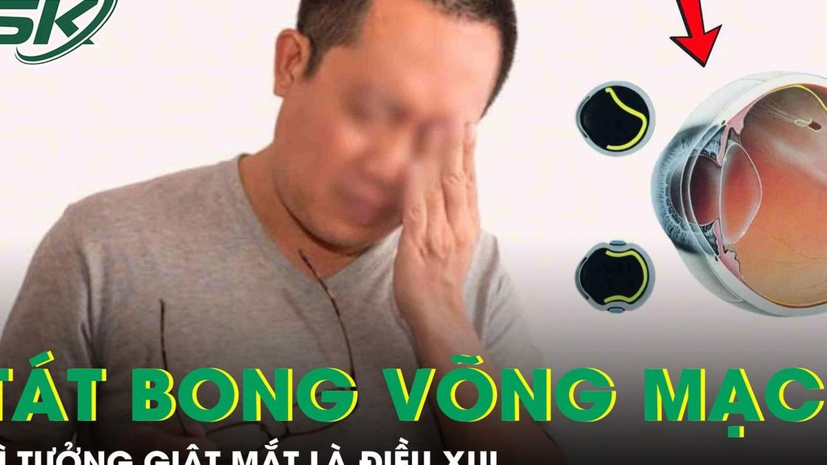 Giật mắt phải tưởng điềm xui, người đàn ông tự tát bong võng mạc, suýt mù mắt - Báo Sức Khỏe &amp; Đời Sống