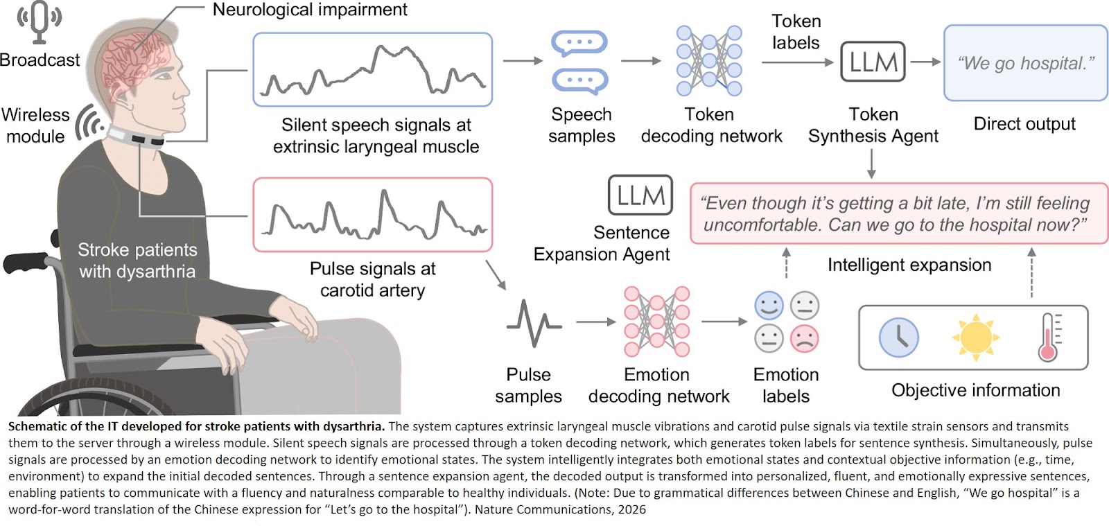 Wearable intelligent throat enables natural speech in stroke patients with dysarthria
