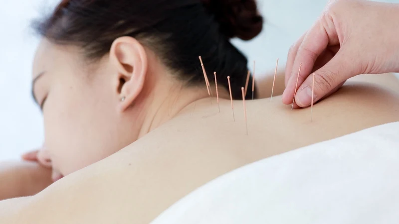 Một số người bệnh lựa chọn phương pháp Đông y để hỗ trợ cải thiện triệu chứng hen suyễn
