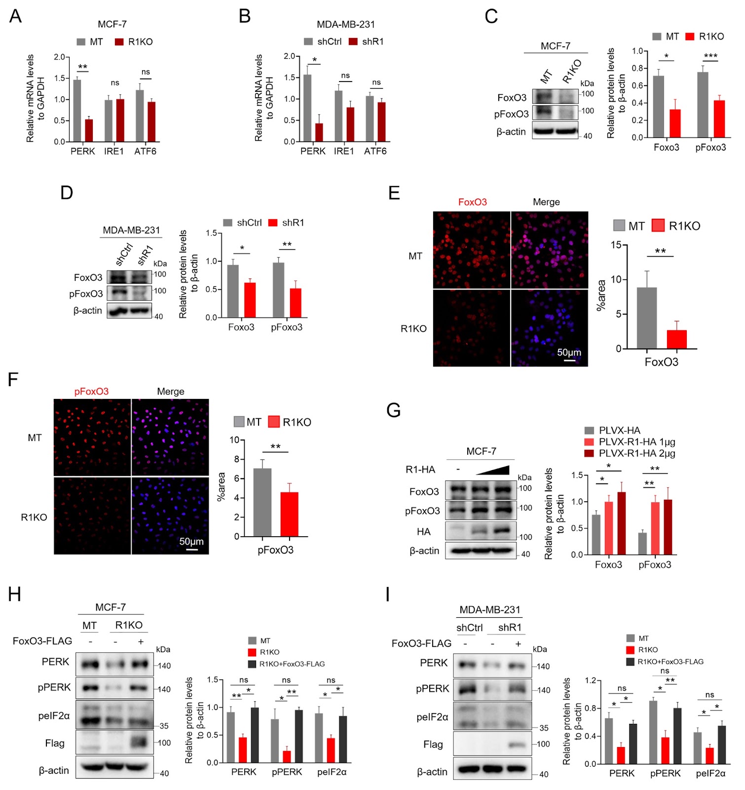 RHBDF1 promotes PERK expression through the JNK/FoxO3 pathway in breast cancer cells