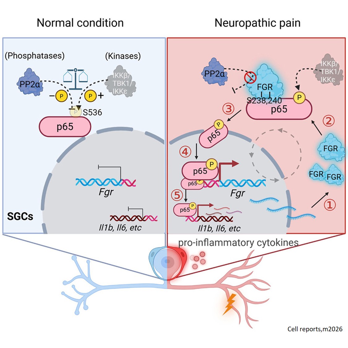 A positive feedback loop between FGR and p65 sustains satellite glial cell activation and chronic neuropathic pain