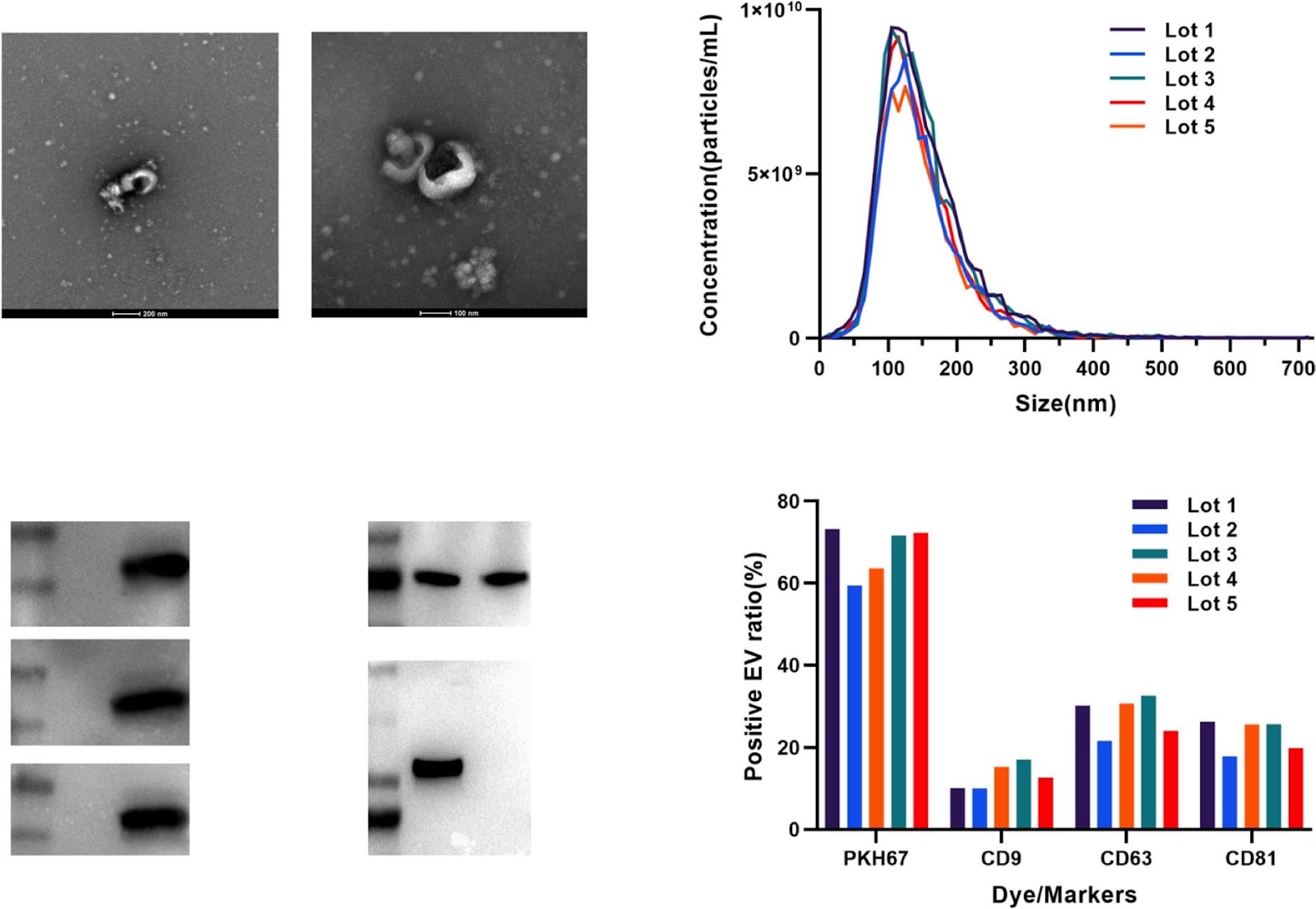 Manufacturing, quality control, and GLP-grade preclinical study of nebulized allogenic adipose mesenchymal stromal cells-derived extracellular vesicles